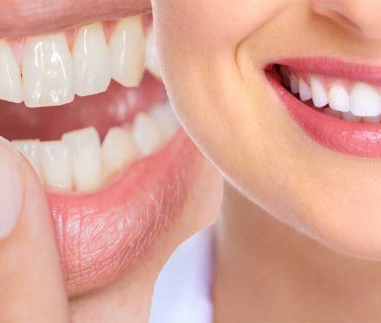Cosmetic Detistry